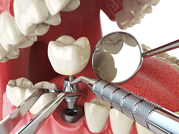 Best Emergency TMJ Treatment in Burton, OH
